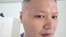 【广西新闻网】广西支援湖北医疗队：男护士的铁汉柔情